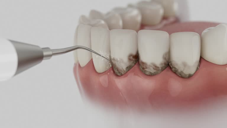Trusted Dental Crowns And Bridges service in Fannett, TX - Dentist Open Now